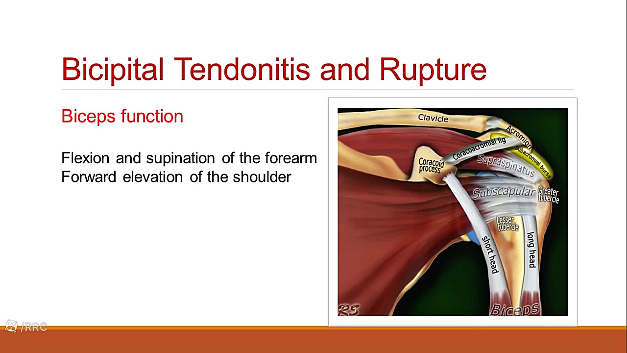 Periarthritis of Shoulder لیفت گردنایمپلنت دندان