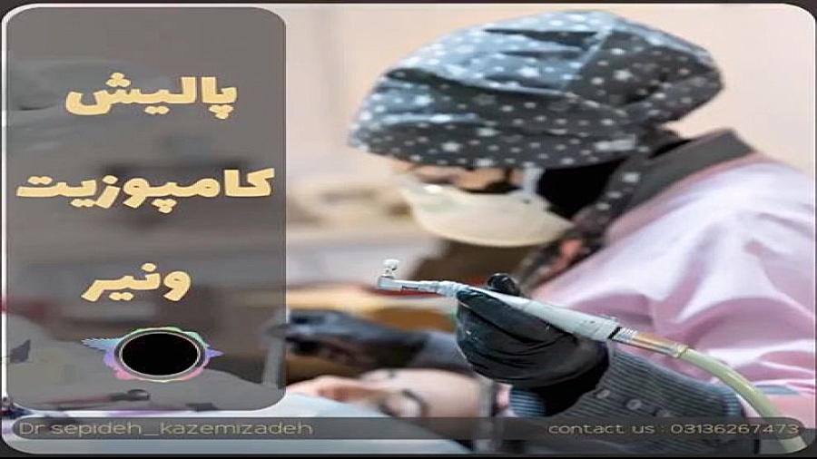پالیش کامپوزیت ونیر دکتر سپیده کاظمی زاده