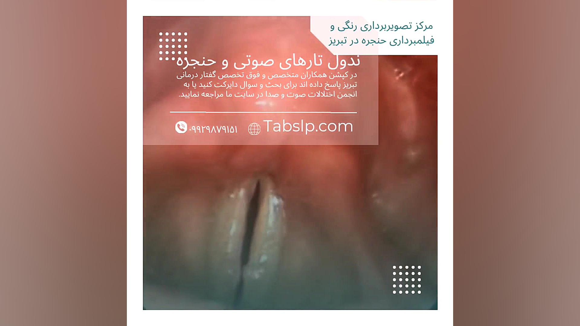 ندول تارهای صوتی اکستنشن تاج دندان
