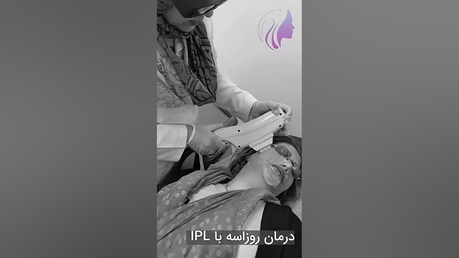 روزاسه یا آکنه روزاسه (Rosacea) دکتر صفیه چعباوی زاده