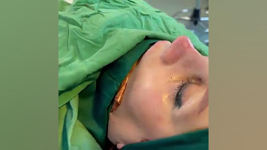 عمل ترمیمی و مجدد بینی دکتر سعید مرزبان