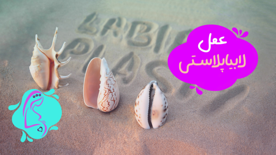 عمل لابیاپلاستی