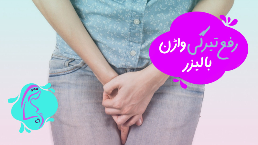 رفع تیرگی واژن با لیزر