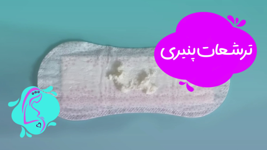 ترشحات پنیری