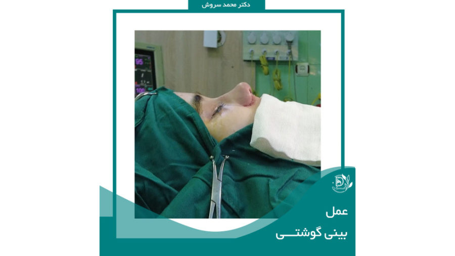 عمل بینی دکتر محمد سروش