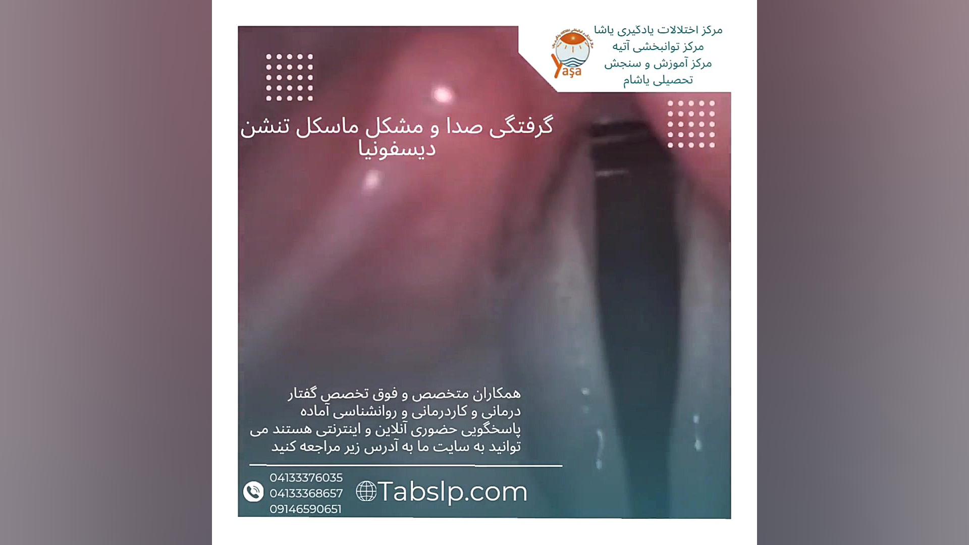 گرفتگی صدا در خواننده ها معلمان و اساتید دانشگاه برداشتن خال