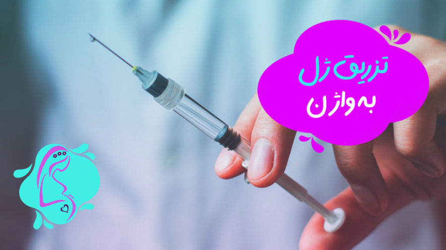 تزریق ژل به واژن