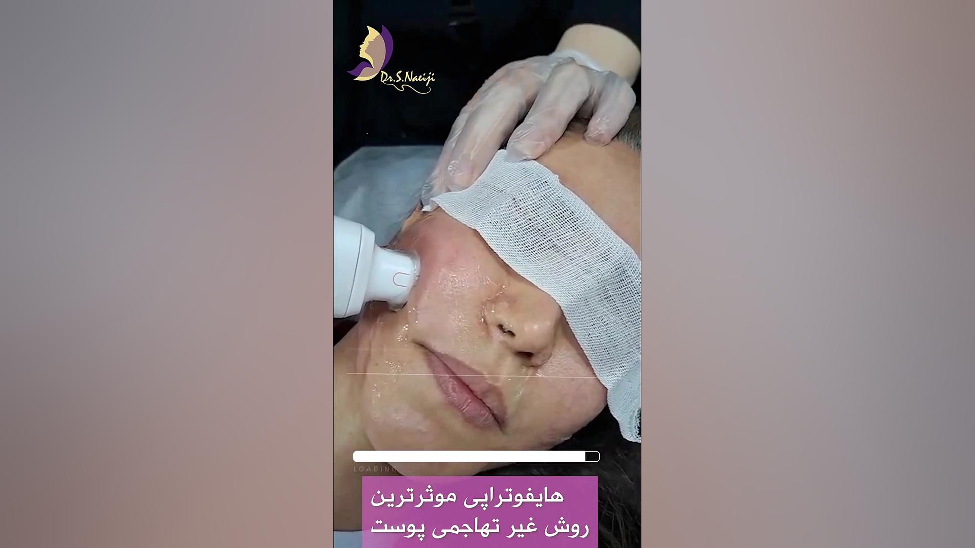 هایفوتراپی روشی غیرتهاجمی دکتر صدیقه نائیجی | متخصص پوست و مو در قم