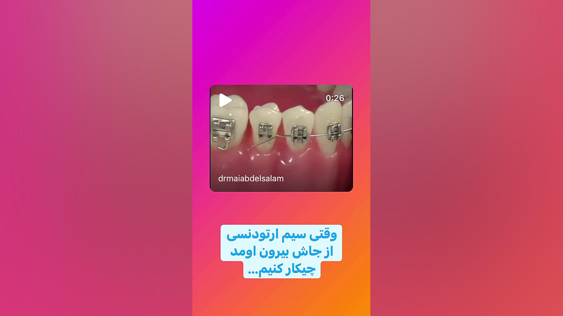 دکتر فهیمی متخصص ارتودنسی ستارخان : مشکلات در ارتودنسی دكتر مهدي فهيمي هنزائي