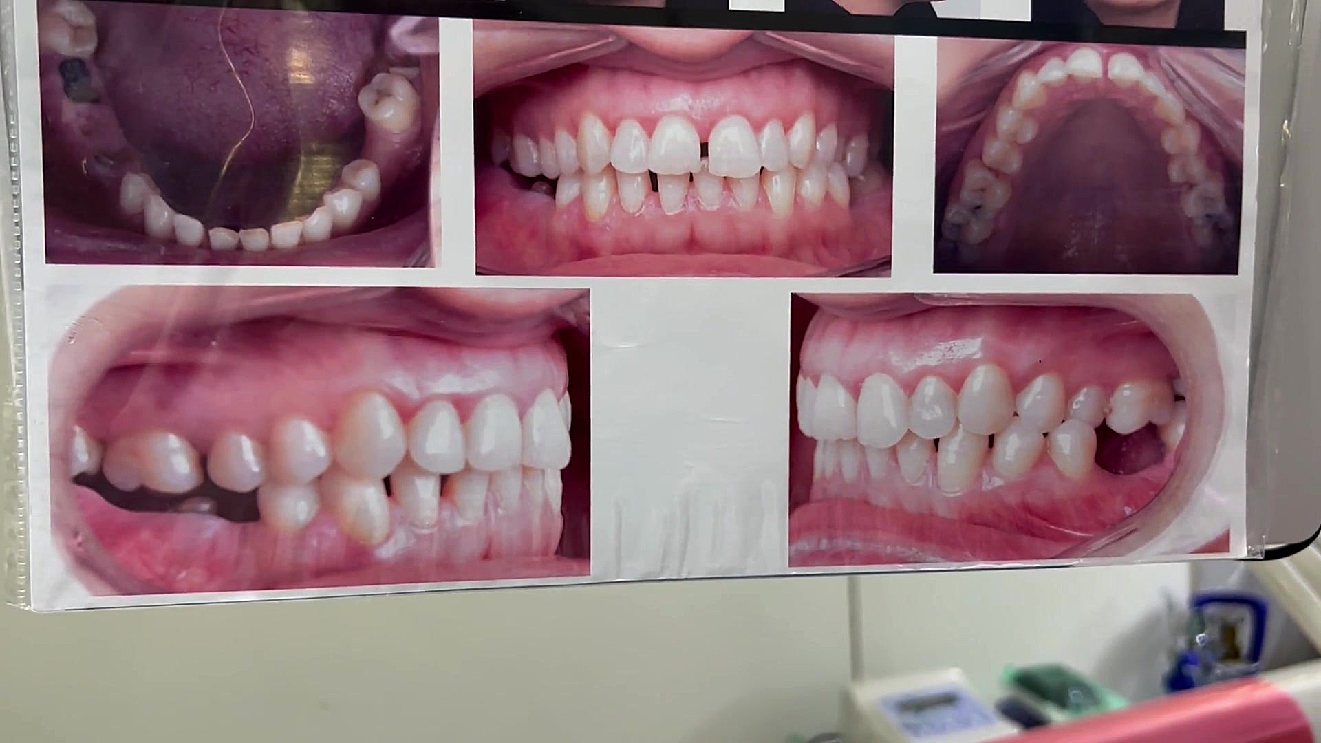 طرح درمام ارتودنسی دکتر مهدی فهیمی متخصص ارتودنسی تهران دكتر مهدي فهيمي هنزائي