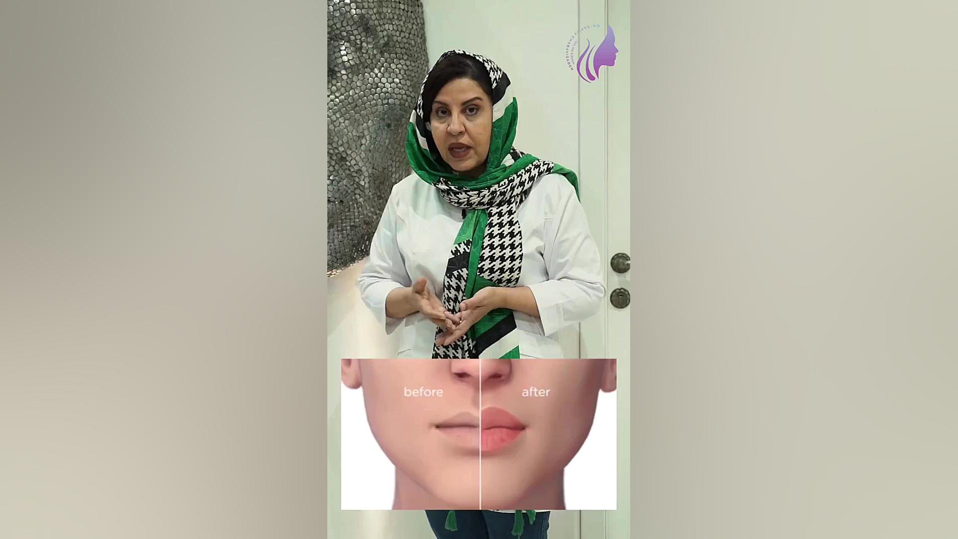 انواع فرم لب دکتر صفیه چعباوی زاده