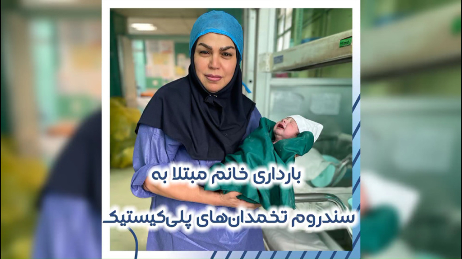 بارداری خانم مبتلا به سندروم تخمدان های پلی کیستیک بررسی لک صورت