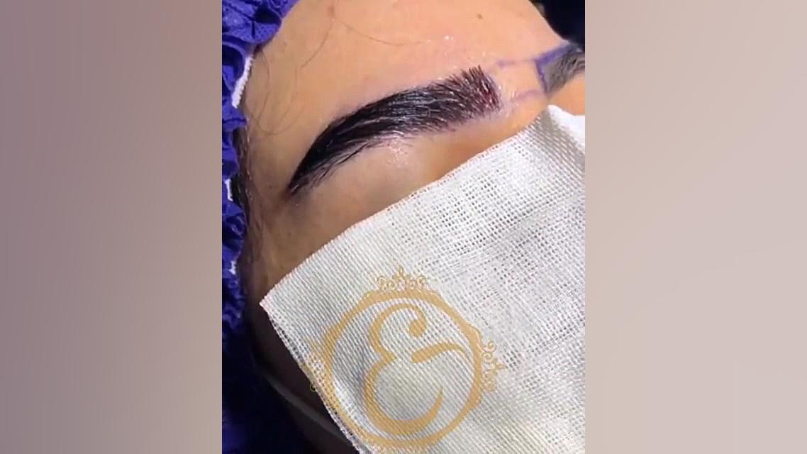 فرم دهی ابرو بر اساس نظر مراجع کلینیک تخصصی پوست و مو تندیس سلامت