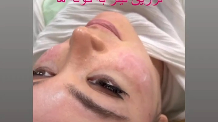 رضایت تعدادی از مراجعه کنندگان در کلینیک دکتر فرحناز زینعلی دکتر فرحناز زینعلی - متخصص پوست، مو، زیبایی زنجان