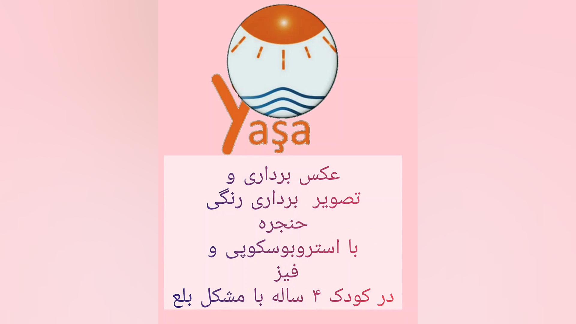 تصویر برداری رنگی از حنجره در تبریز ابرسانی پوست