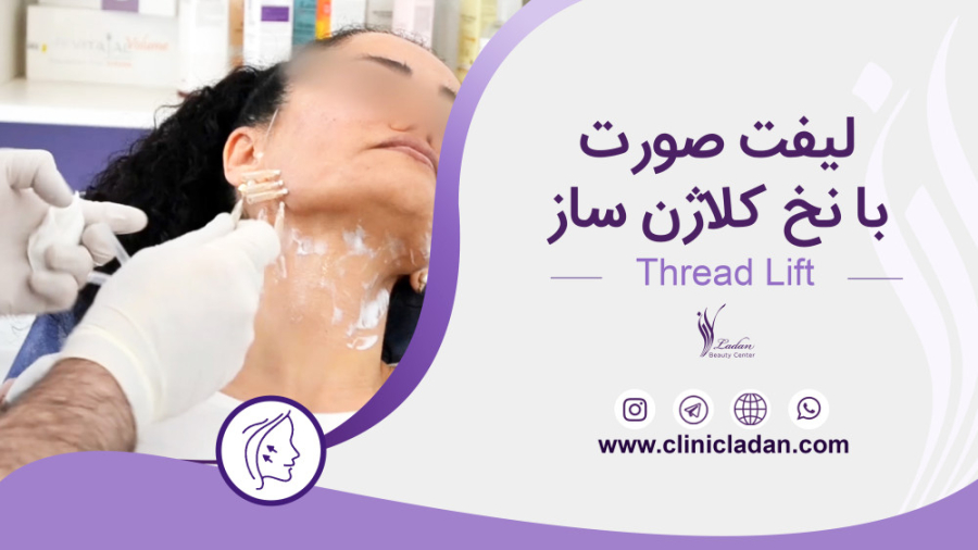 نخ کلاژن ساز بلیچینگ دندان