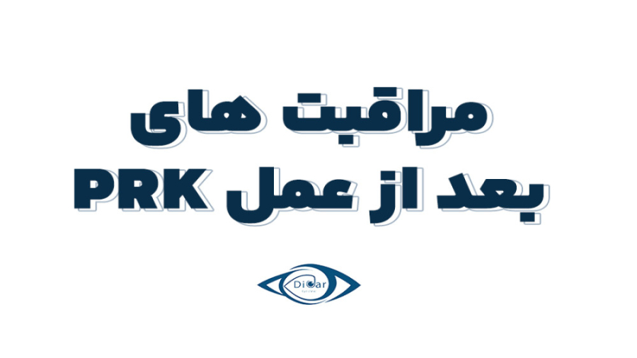 مراقبت های بعد از عمل PRK دکتر محمدرضا صداقت
