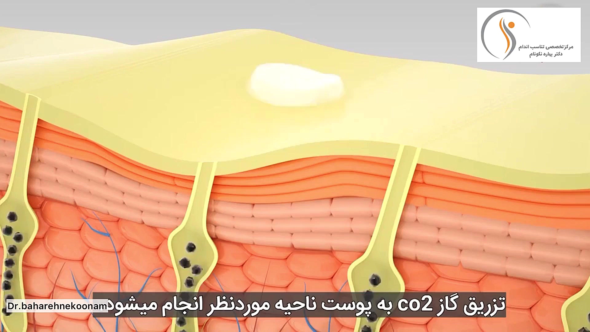 نحوه عملکرد دستگاه کربوکسی تراپی دستگاه بیومتریک پوشیدنی