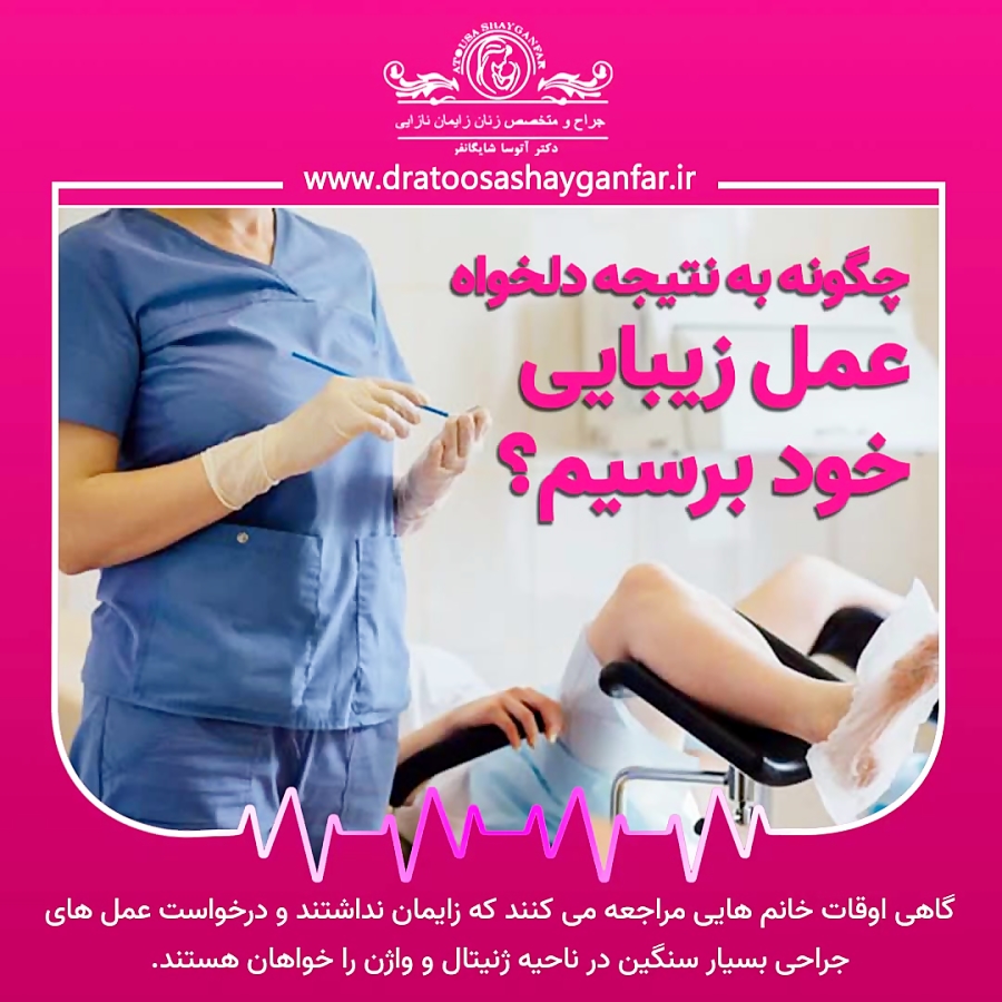 عمل زیبایی واژن