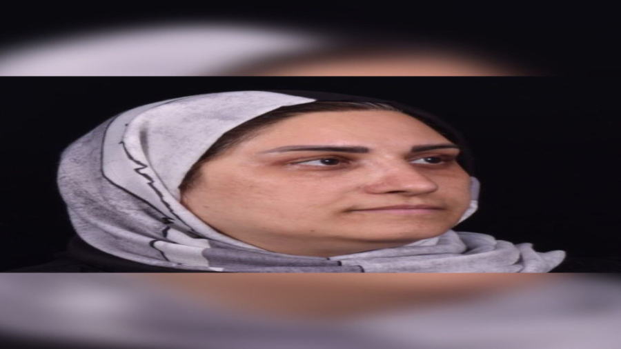 عمل همزمان رینوپلاستی، لیفت پیشانی و بلفاروپلاستی دکتر حمید رضا فتحی فوق تخصص جراحی پلاستیک