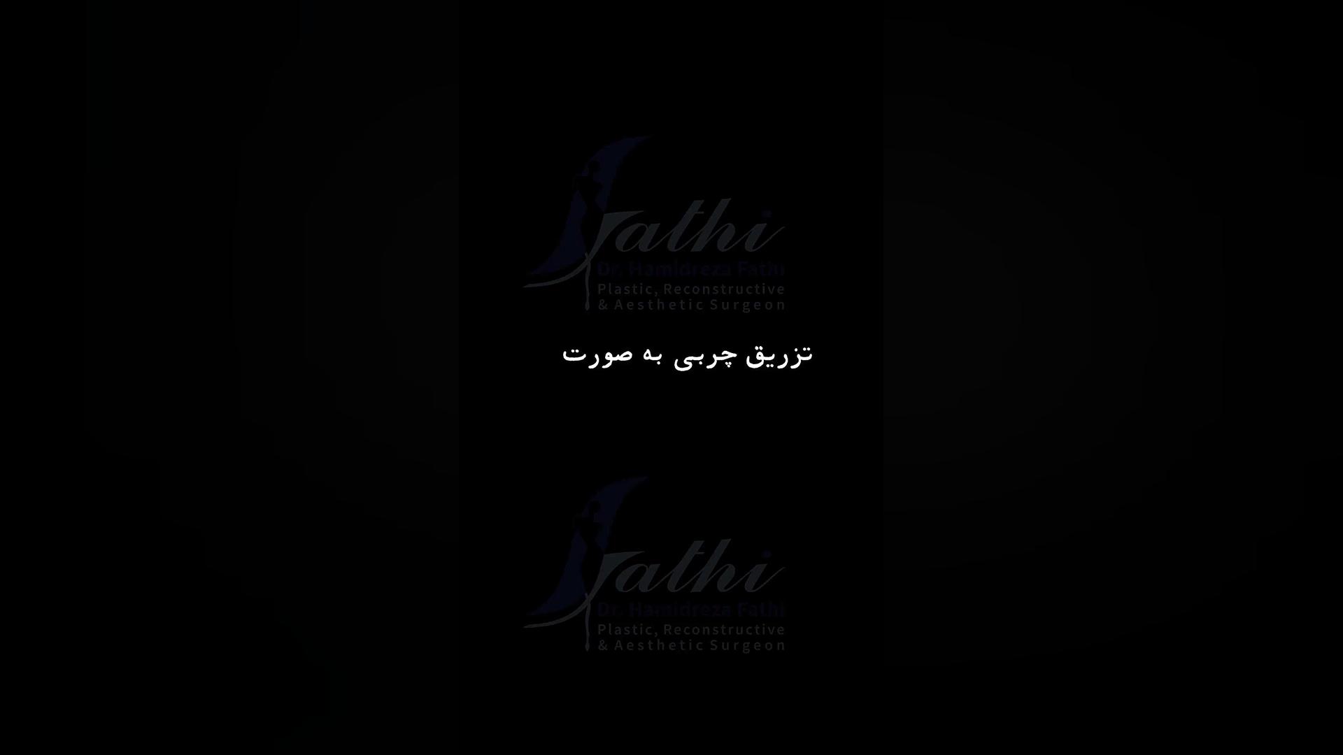 تزریق چربی به صورت دکتر حمید رضا فتحی فوق تخصص جراحی پلاستیک
