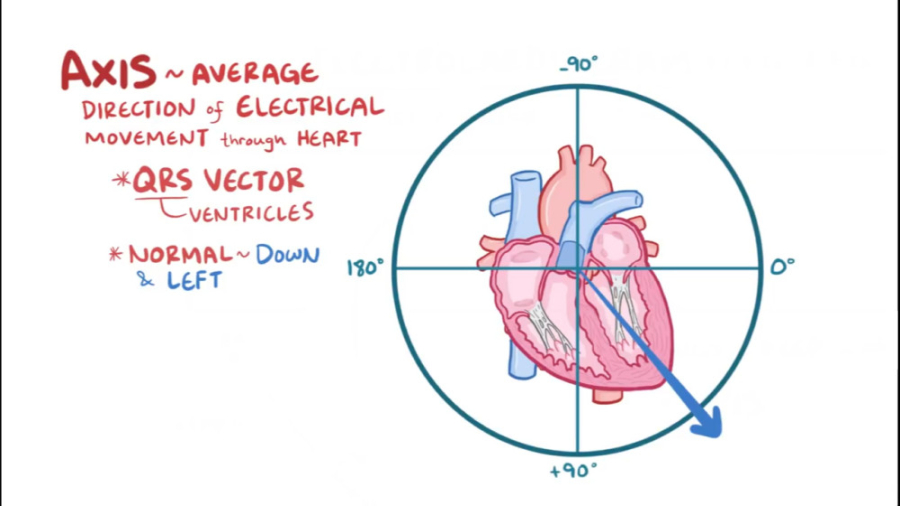 محور در نوار قلب (ECG axis) - اسموزیس ماموپلاستی