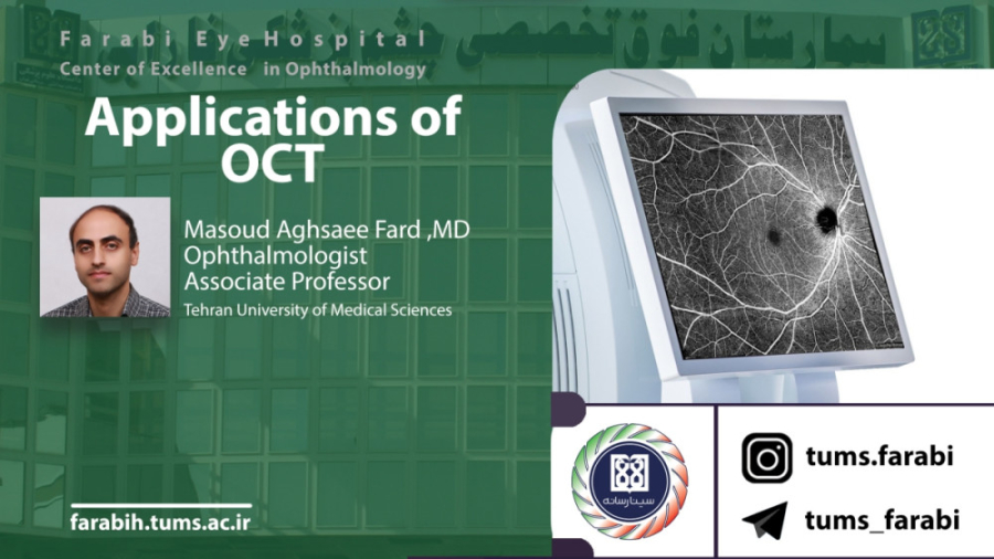Applications of OCT - M.Aghsaee Fard MD / دانشگاه علوم پزشکی تهران هایپوفلکسی