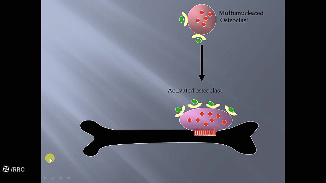 Pathophysiology and Classification of Osteoporosis ترمیم زیبایی دندان