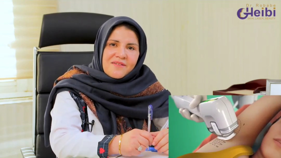 بوتاکس زیر بغل دکتر ربابه غیبی