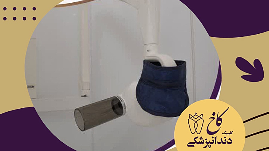 رادیوگرافی در کلینیک دندانپزشکی کاخ کلینیک دندانپزشکی کاخ