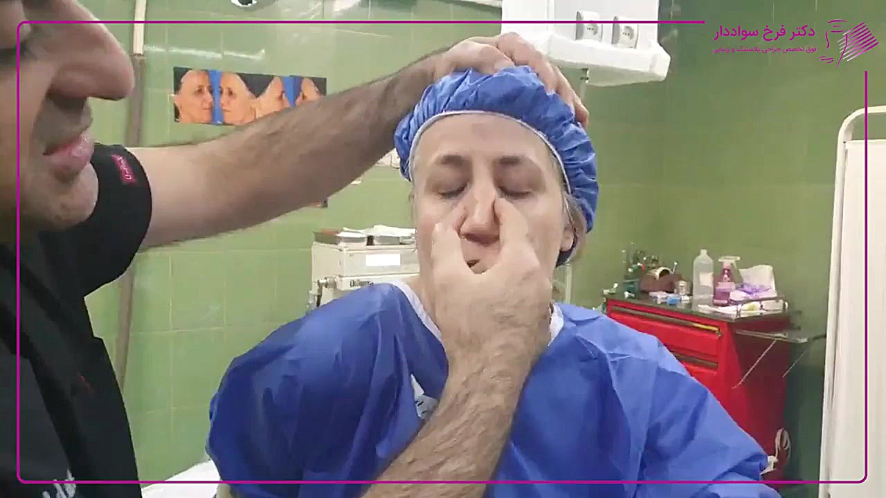 رینوپلاستی خانم 44 ساله دکتر فرخ سواددار