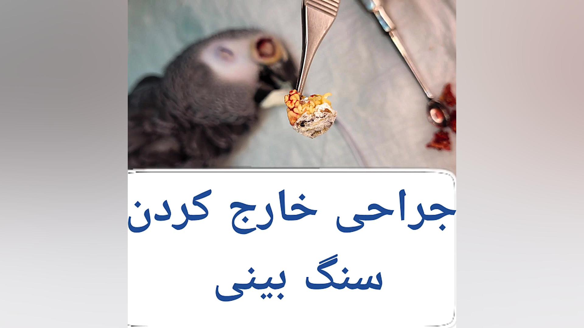 جراحی خارج کردن سنگ بینی کاسکو دکتر علی برهانی کیا