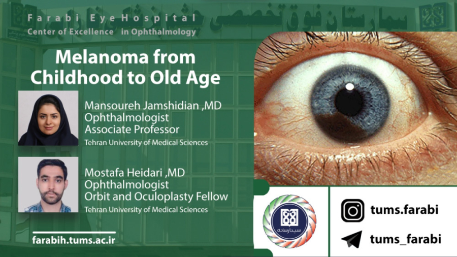 Melanoma from Childhood to Old Age / دانشگاه علوم پزشکی تهران بیماری پیرفیریک نوروپاتی