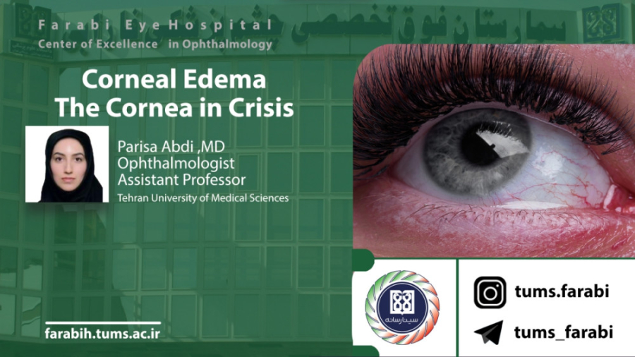 Corneal Edema, The Cornea in Crisis - P.Abdi MD / دانشگاه علوم پزشکی تهران کشیدن دندان
