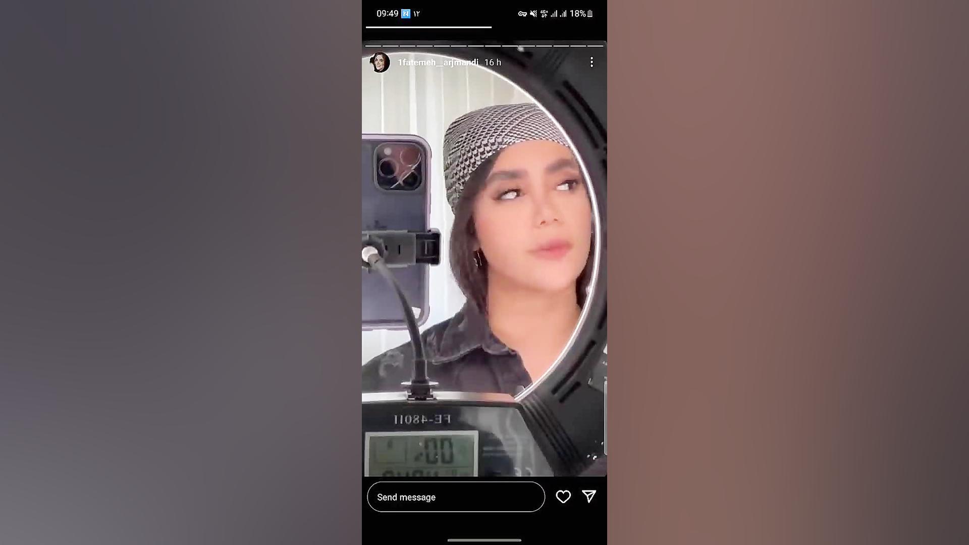 فیلر فوری حجم دهنده لب(بین ۳۰ الی ۷۰ درصد) سفارش ۰۹۰۲۳۱۱۵۰۴۰ زمان82ثانیه