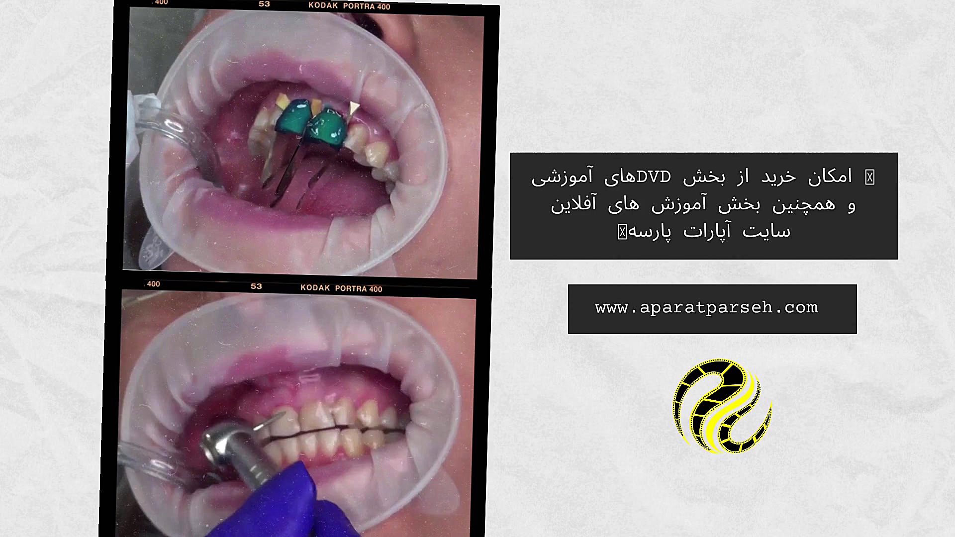 "کامپوزیت ونیر (تکنیک لیرینگ)" "Composite Veneer(Layering Technique)" پلتفرم Drug Screening