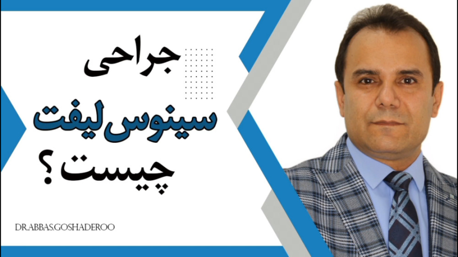 جراحی سینوس لیفت چیست دکتر عباس گشاده رو، متخصص جراحی لثه و ایمپلنت