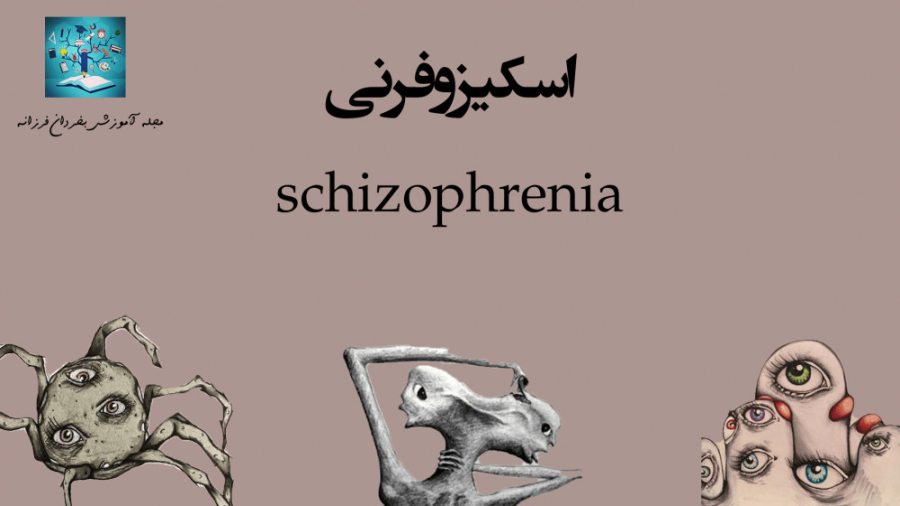 بیماری روانی اسکیزوفرنی (schizophrenia) عصب‌کشی
