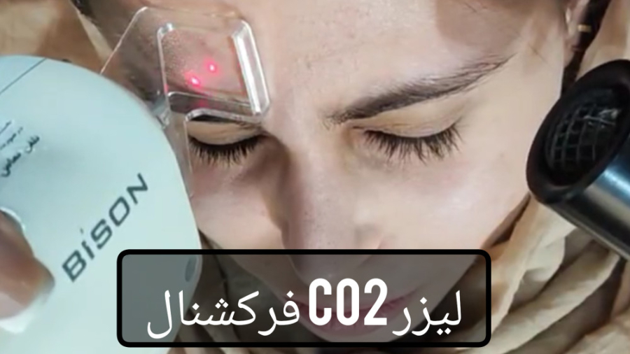لیزر co2 فرکشنال دکتر ریحانه مهرگان