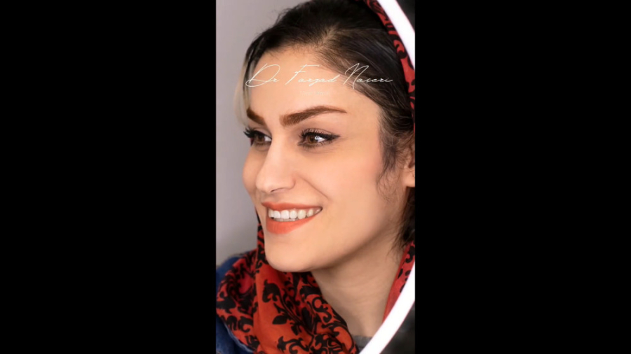 ارتودنسی ثابت دو فک دکتر فرزاد ناصری متخصص ارتودنسی در اصفهان