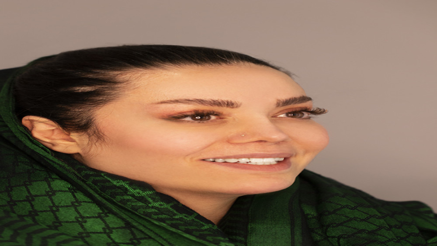 ارتودنسی ثابت دو فک قبل از کامپوزیت دندان دکتر فرزاد ناصری متخصص ارتودنسی در اصفهان