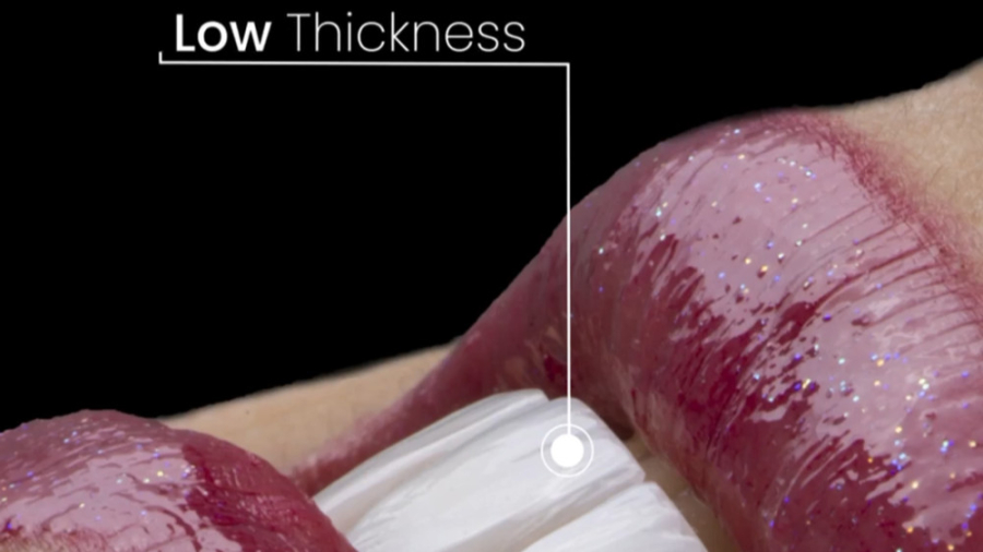 لمینت دندان در کلینیک دندانپزشکی دکتر قاسم نژاد دندانپزشکی زیبایی دکتر قاسم نژاد