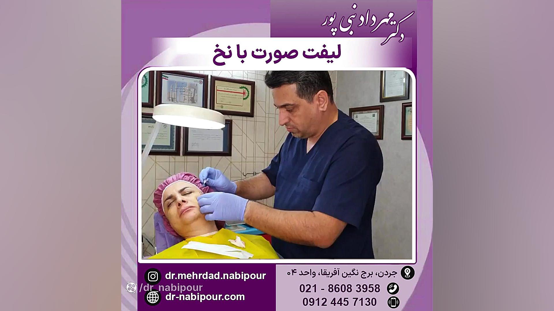 لیفت صورت با نخ دندانپزشک زیبایی