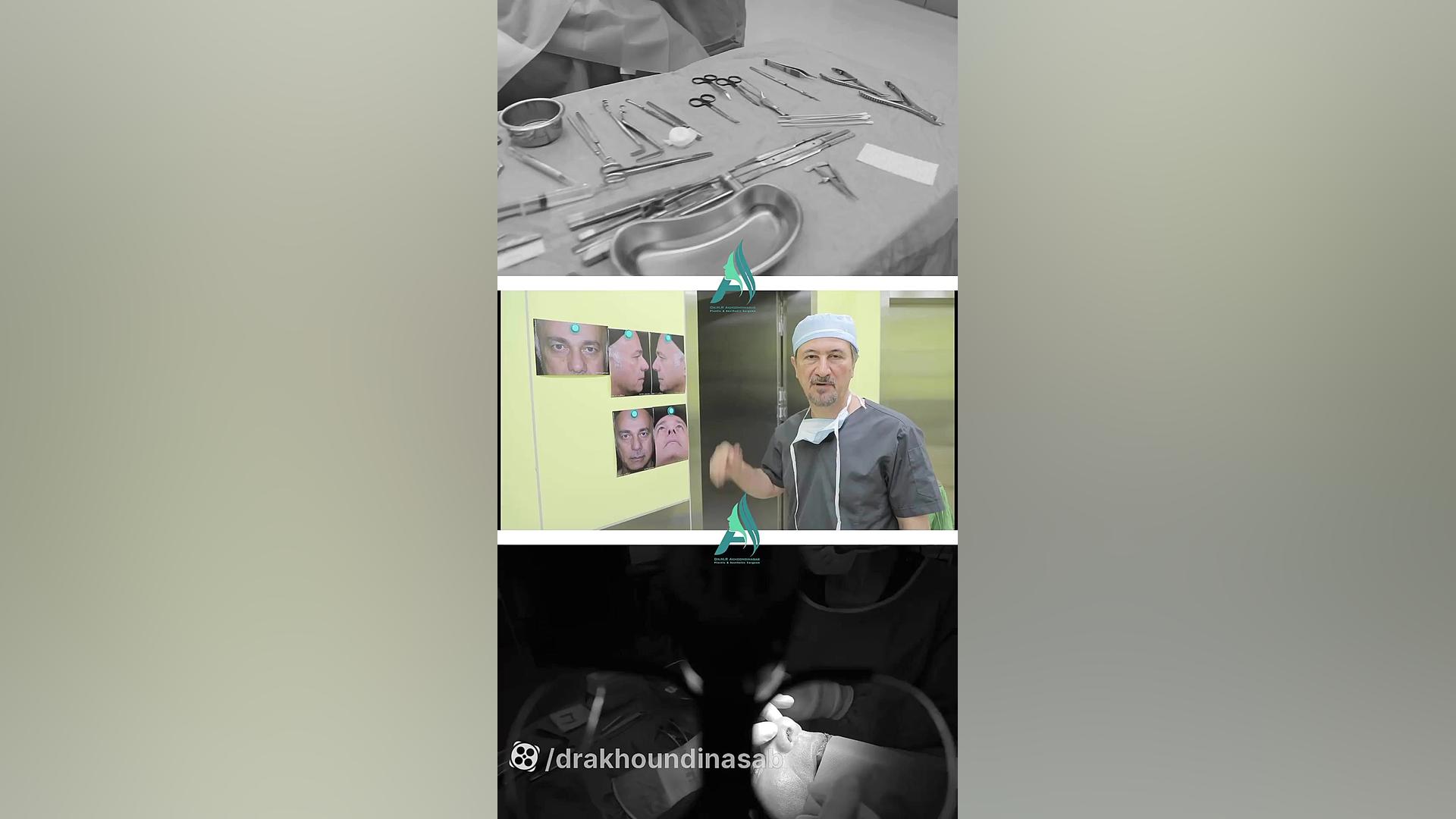 جراحی همزمان رینوپلاستی و بلفاروپلاستی دکتر محمدرضا آخوندی نسب-فوق تخصص جراحی پلاستیک
