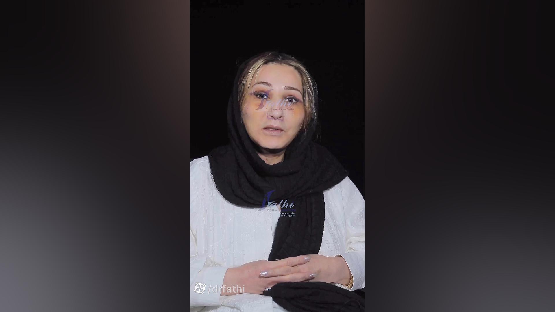 نتیجه جراحی لیفت صورت دکتر حمیدرضا فتحی ماموپلاستی