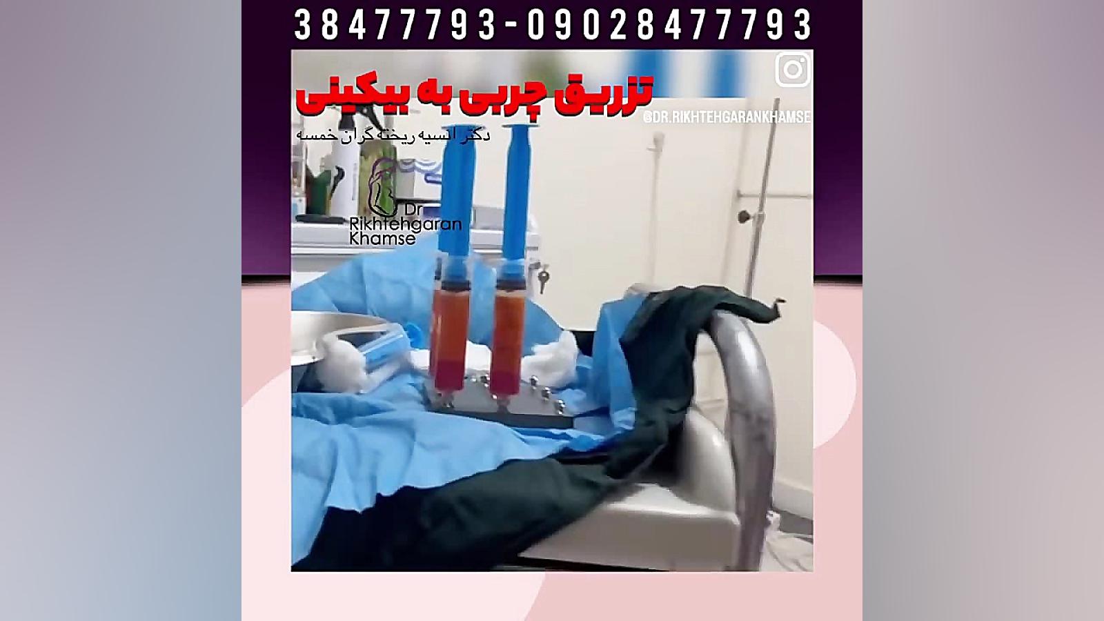 تزریق چربی به بیکینی در مشهد بیومهندسی عصبی