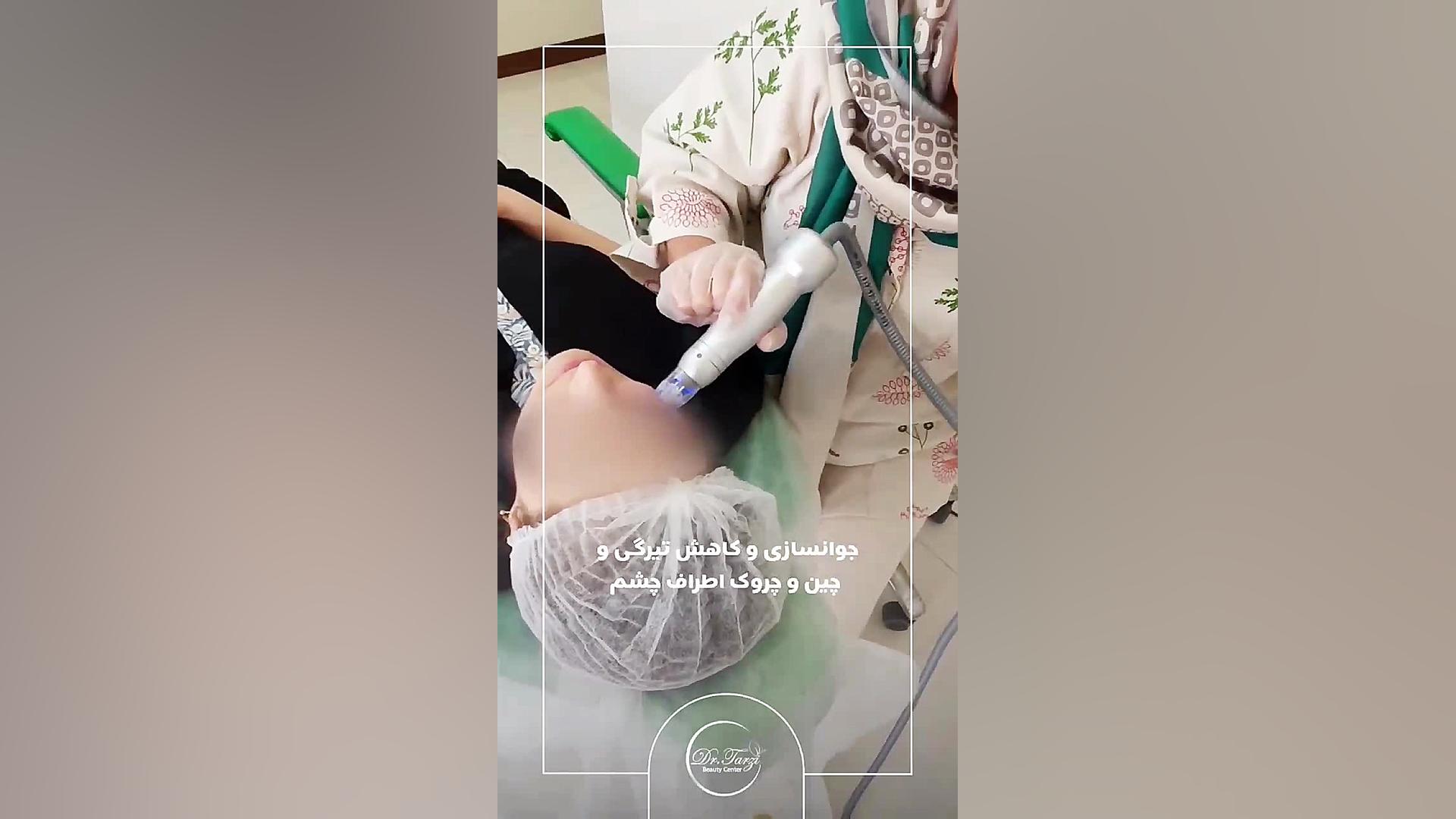 جوانسازی اطراف چشم، کاهش تیرگی دور چشم با انجام آر اف فرکشنال MRCP