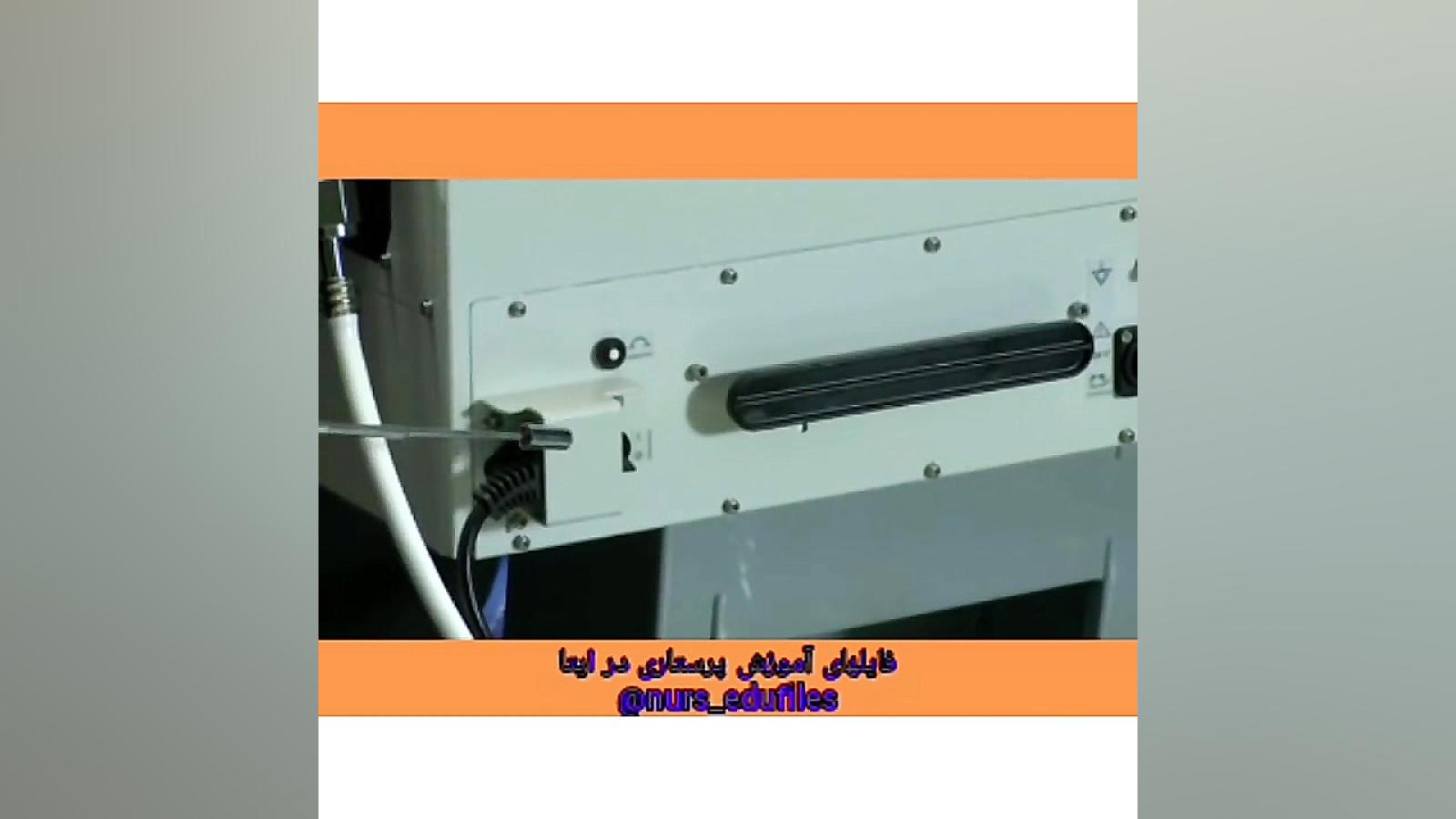 آموزش کار با ونتیلاتور ۷۶۰ جراحی زیبایی پلک