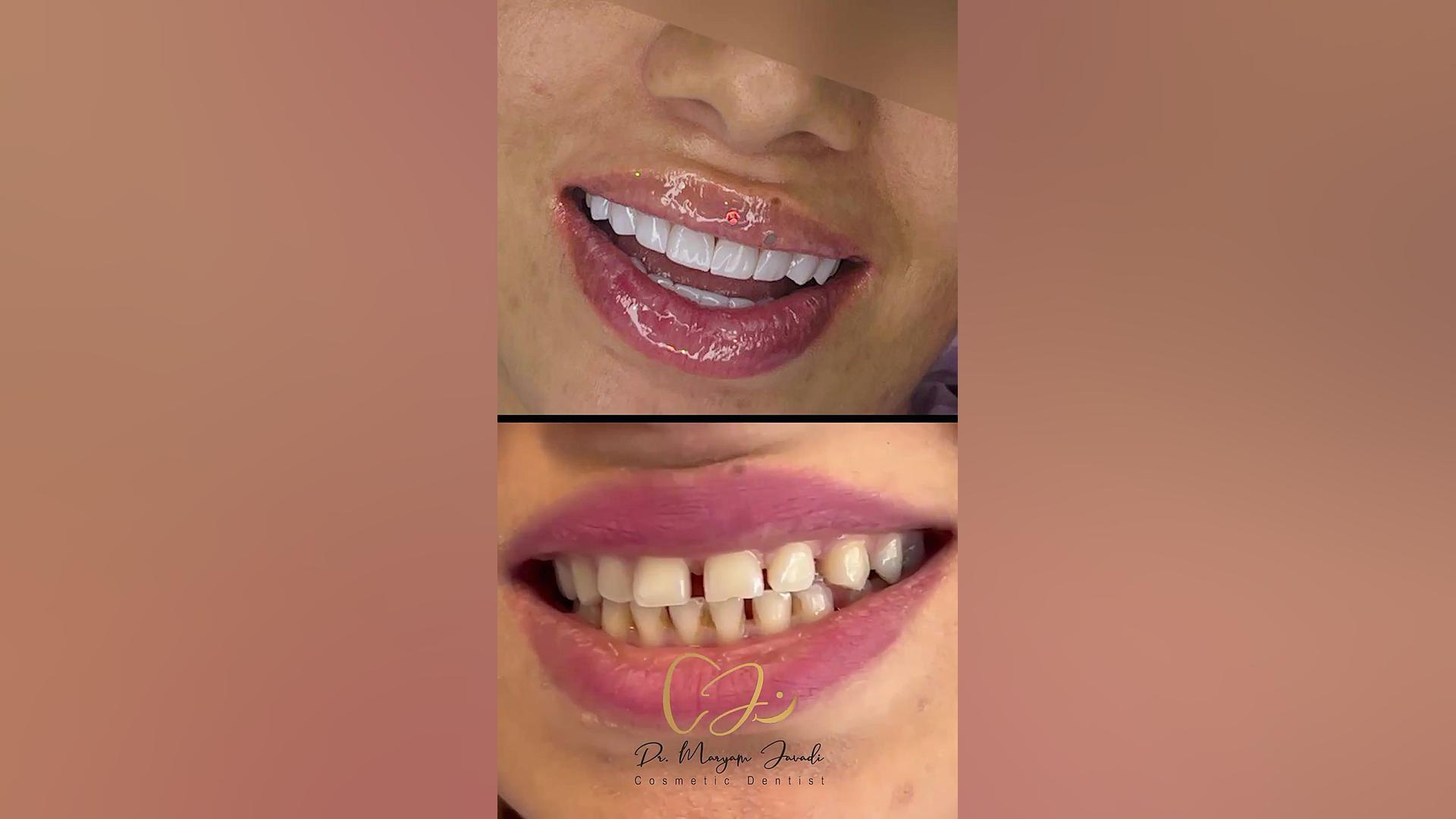 اصلاح طرح لبخند پاکسازی پوست