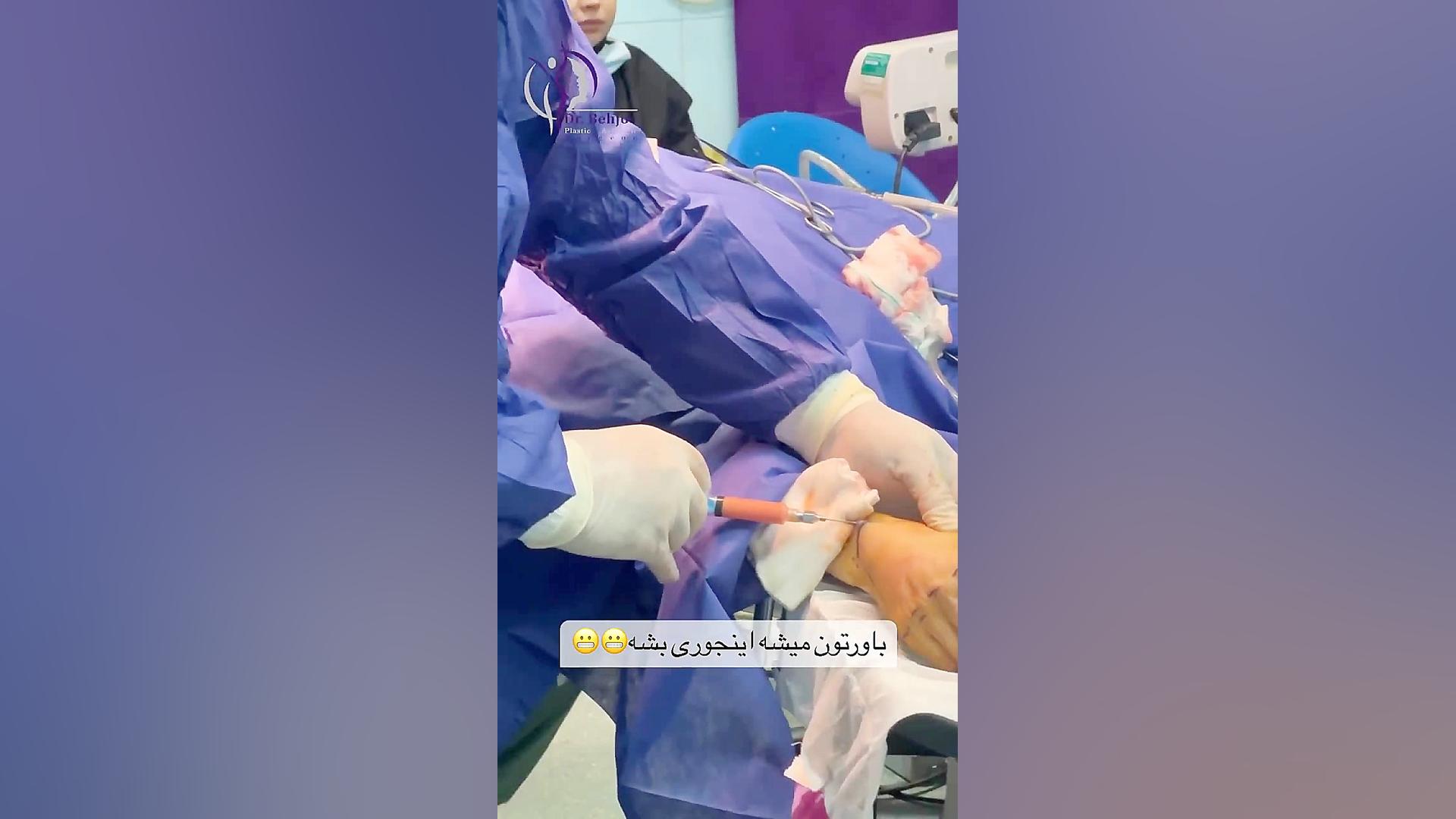 جوانسازی دست با تزریق نانوفت دکتر شاهین بهجو - فوق تخصص جراحی پلاستیک